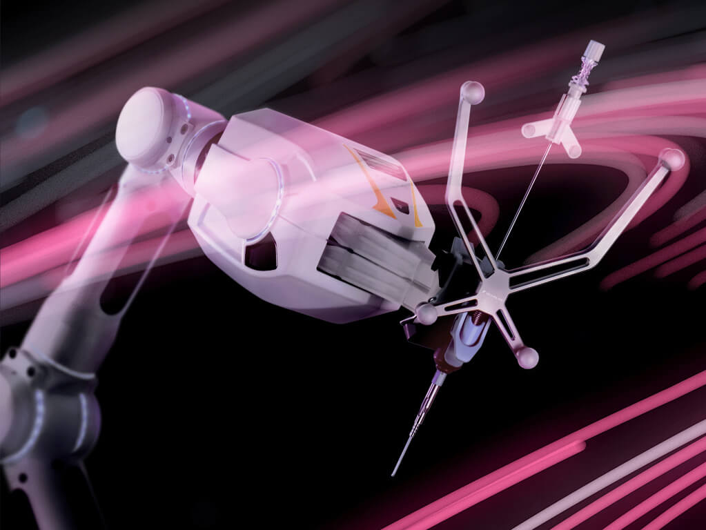 Se muestra un sistema de brazo quirúrgico robótico Cirq sujetando un módulo para biopsias craneales sobre un fondo negro con líneas rosas transparentes girando alrededor