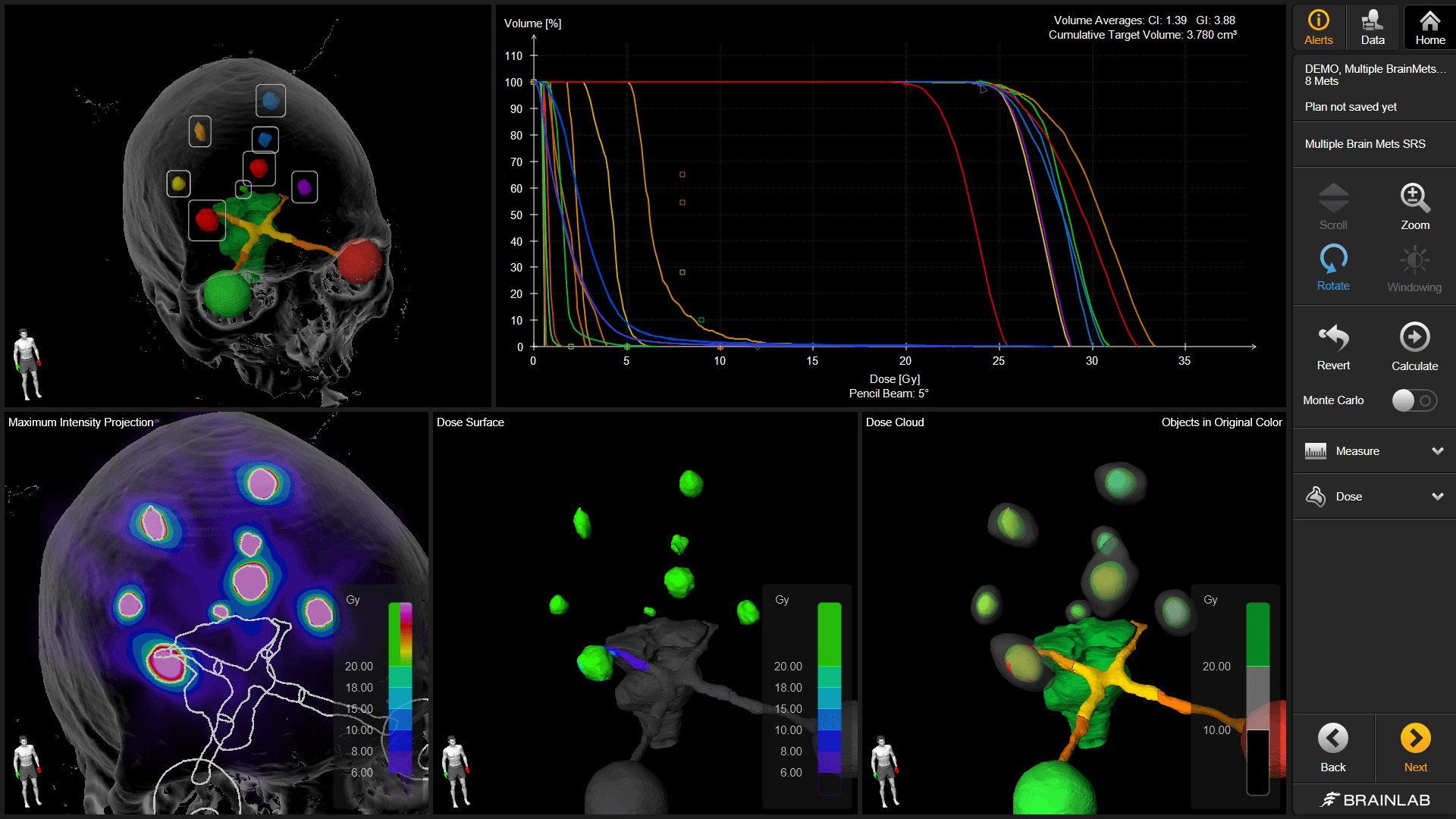 Captura de tela do software Brainlab Elements demonstrando diversas visualizações e dados disponíveis que ajudam os usuários a conseguir um planejamento de tratamento radioterápico e de radiocirurgia consistente.