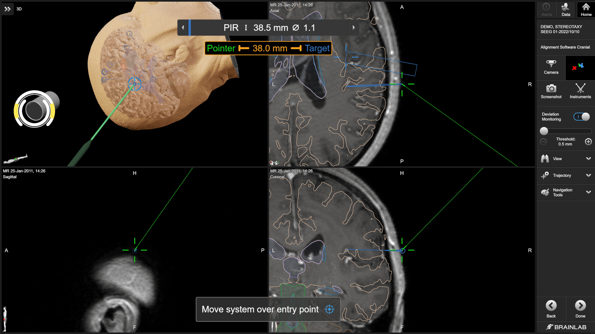 Rotação tátil da visualização do microscópio para revelar mais detalhes anatômicos
